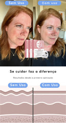 Máscara de colágeno absorvível + ativos do botox BiocollagenPlus